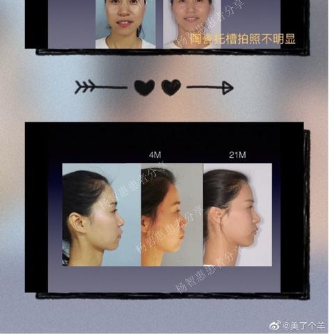 蛋白矫正产品榜单TOP10
